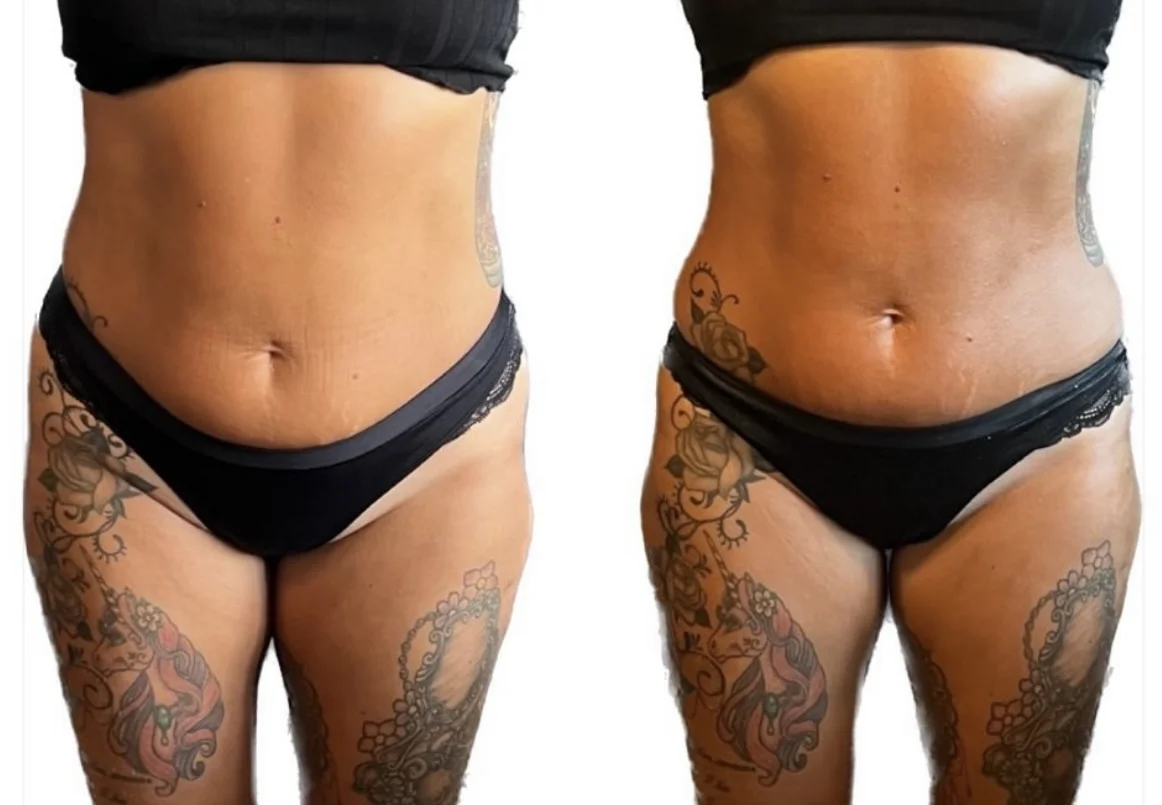 bodyby_sj 8